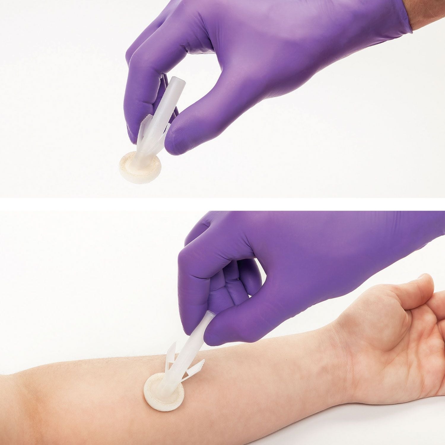 ChloraPrep Patient Preoperative Skin Preparation Applicator | Clear | 3ml | Pack of 25