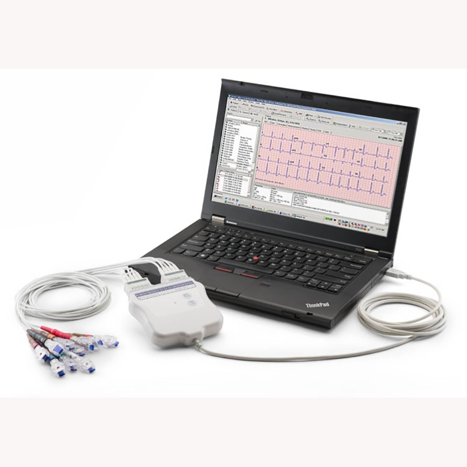 Welch Allyn Cardioperfect Workstation PC-Based Resting ECG, Non-Interpretive