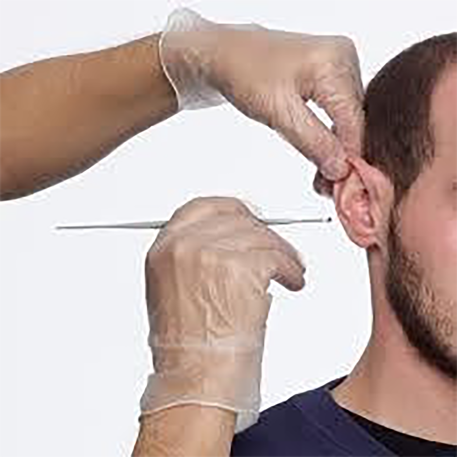 Propulse Proscoop Ear Wax Removal Scoop | Pack of 40