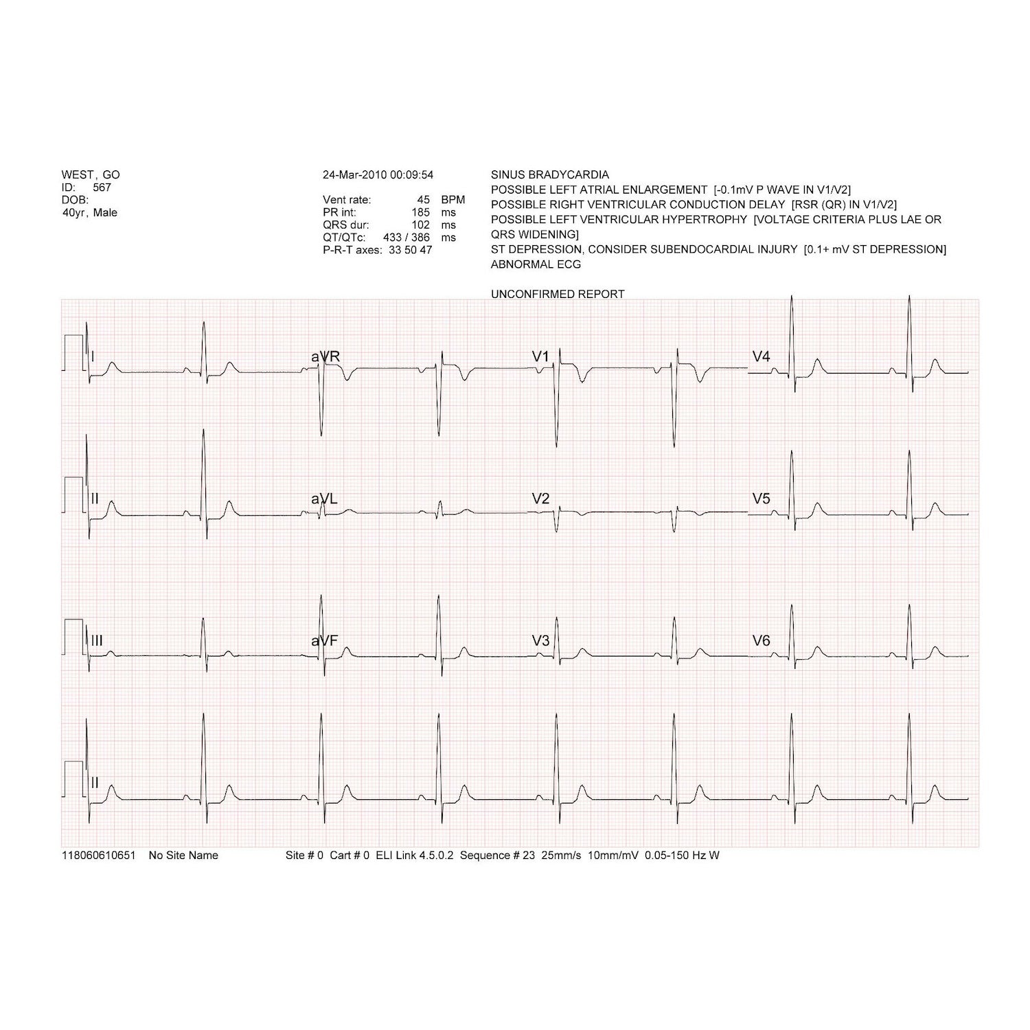 Welch Allyn/Mortara Eli150c ECG with standard patient cable (1)