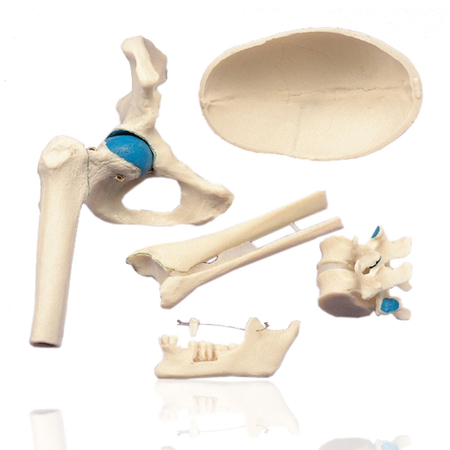 Joints - Set of 5